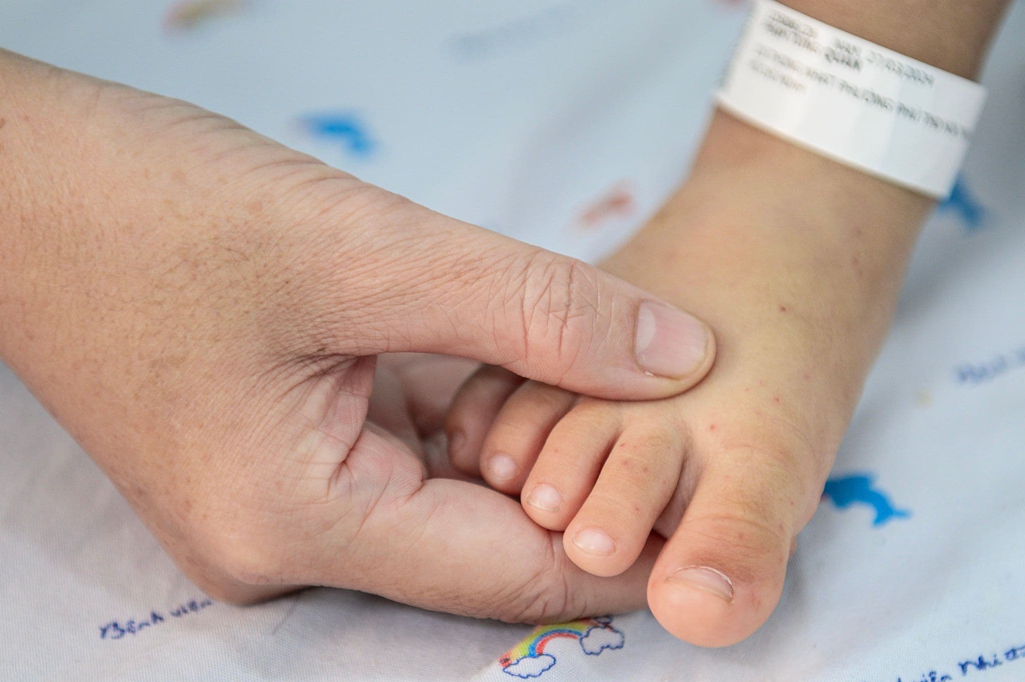 Bàn tay người lớn nắm chân trẻ nhỏ bị nổi ban đỏ, dấu hiệu bệnh tay chân miệng