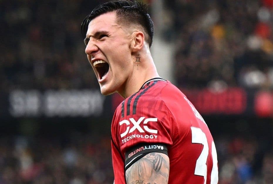 Cầu thủ Manchester United thể hiện sự quyết tâm và áp lực trong trận đấu