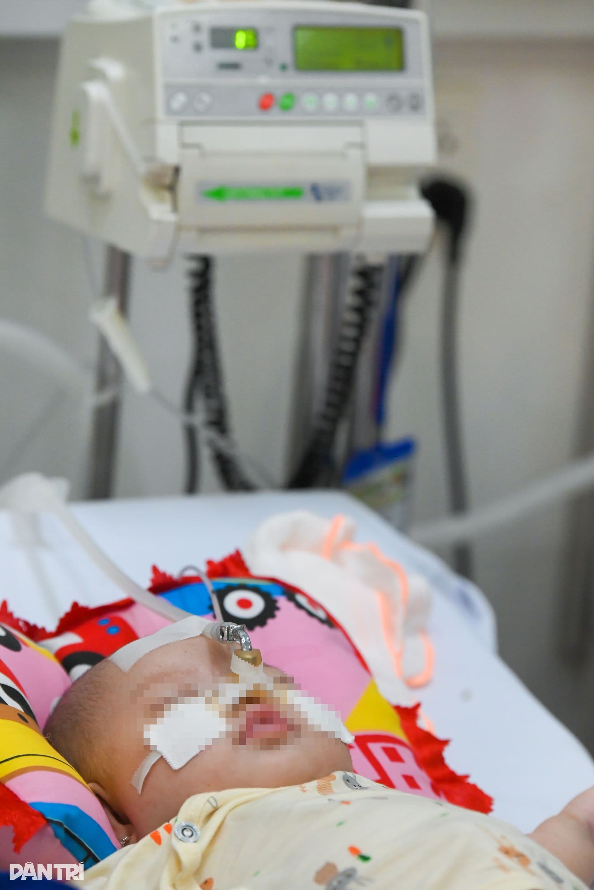 Em bé nằm trên giường bệnh với thiết bị y tế, biểu thị các tín hiệu 'cầu cứu' của cơ thể khi bệnh hô hấp trở nặng.