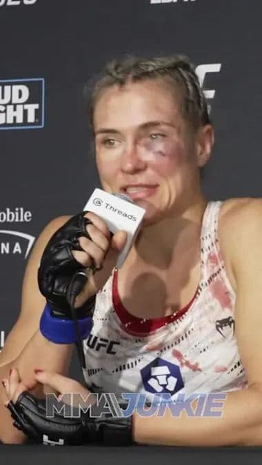 Võ sĩ Yana Santos với vết bầm tím trên mặt sau trận đấu tại UFC 320, thể hiện sự khắc nghiệt của giải đấu.